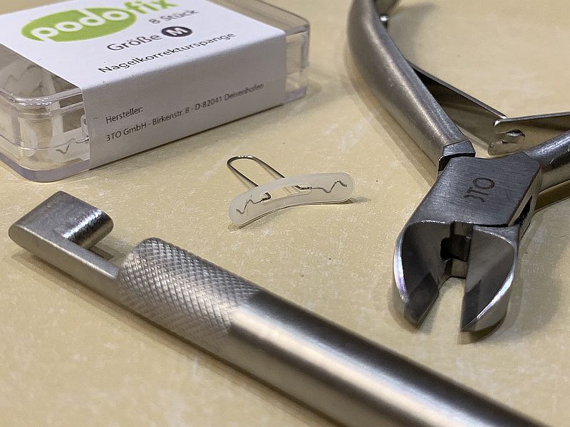 Nagel-Korrektur-Spangen bei hartnäckig eingewachsenen Nägeln