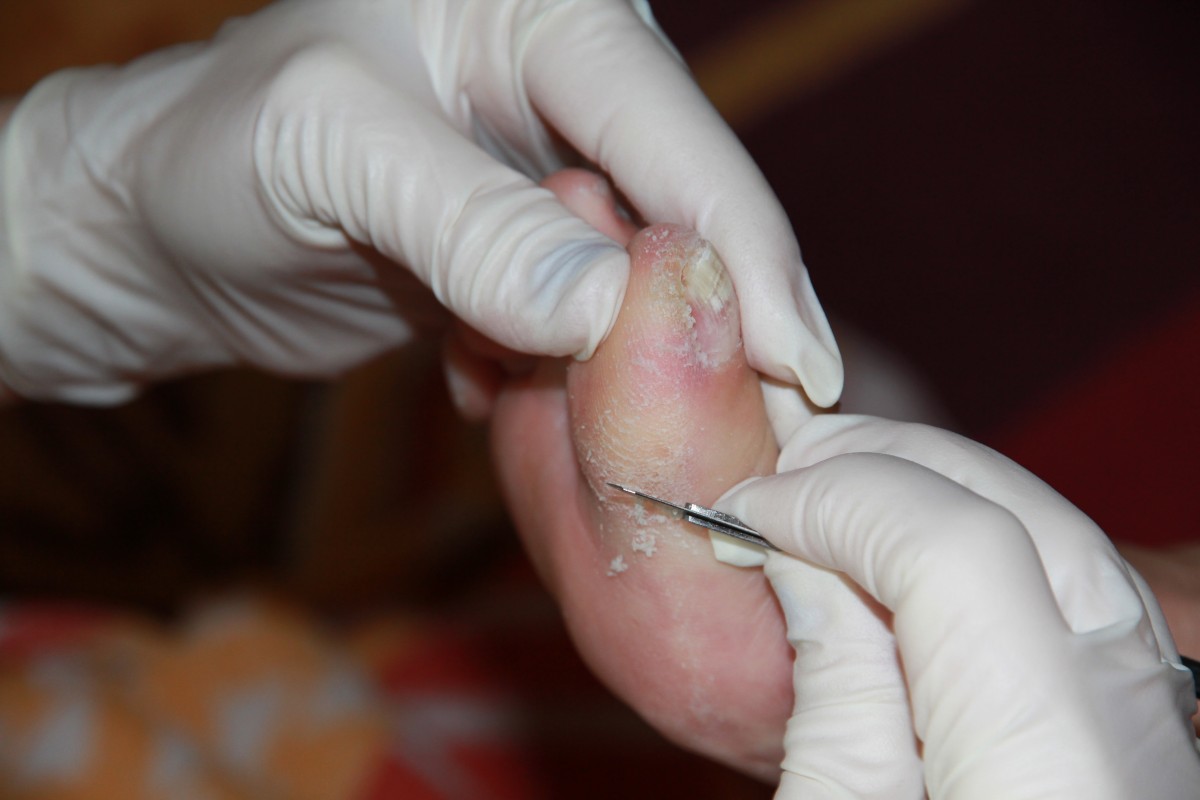 Medizinische Fußpflege dürfen wir uns nicht nennen